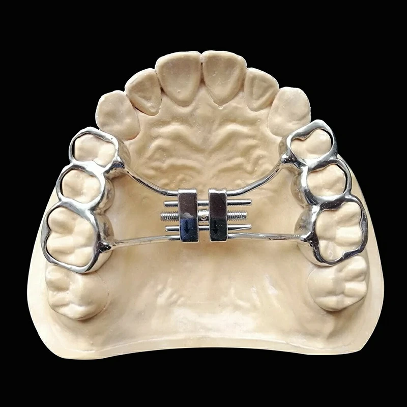 Dental Removable Rapid Palate Expander